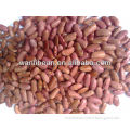 Light Red Kidney Beans